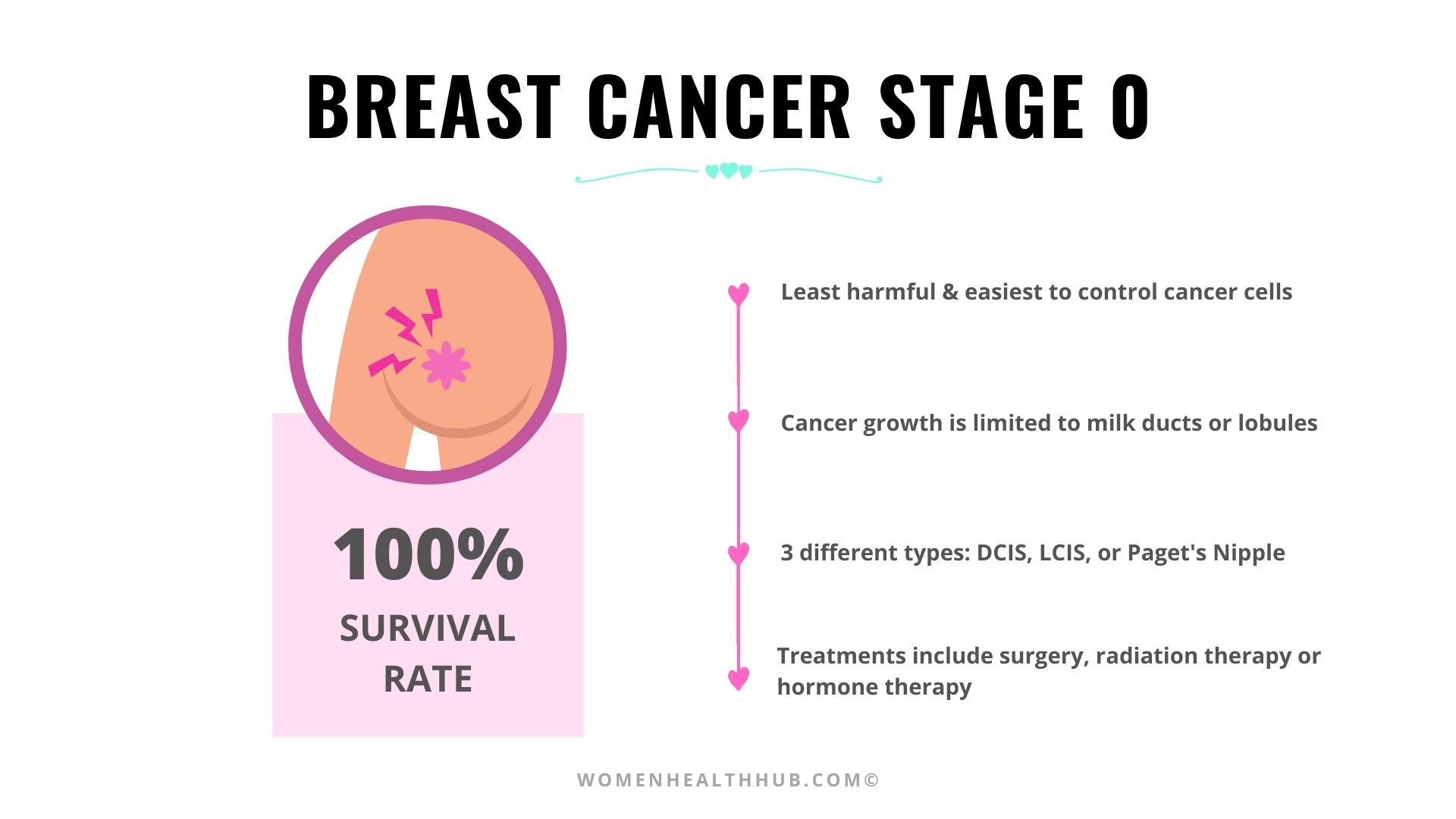 Everything About 5 Stages Of Breast Cancer With Treatments