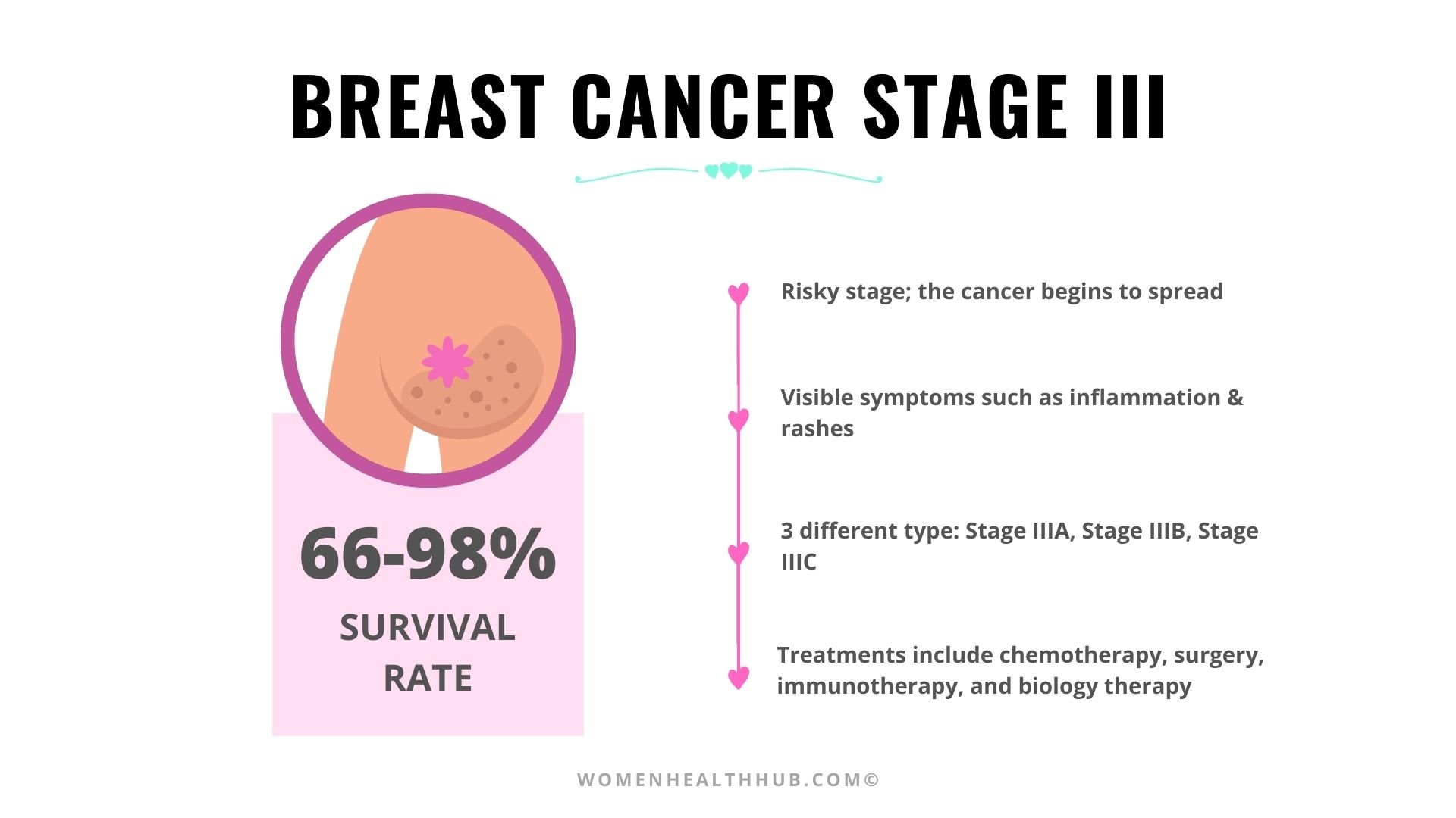 Everything About Stages Of Breast Cancer With Treatments