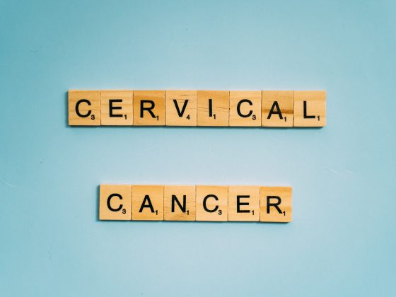 Experts Share Tips to Avoid Cervical Cancer - Women Health Hub